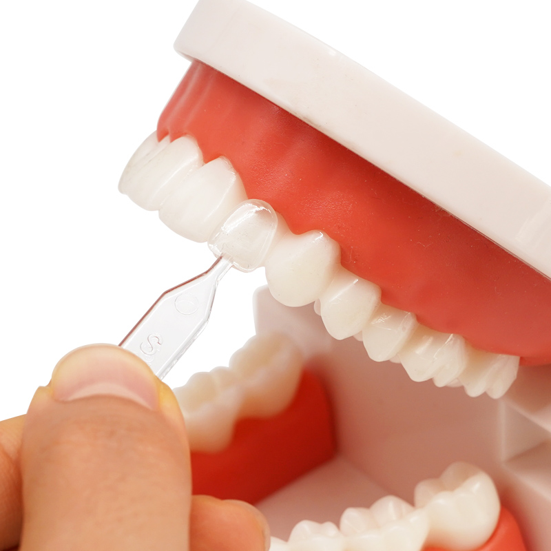 30 Pz Impiallacciature Dentali - Teeth Whitening Moulds recensione e prezzo