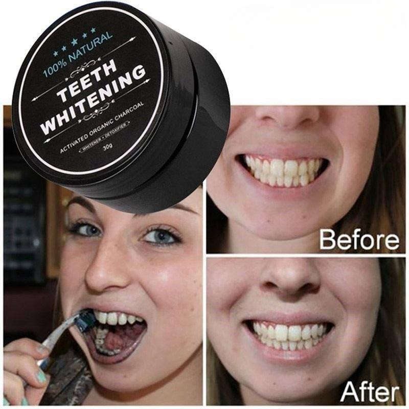1 scatola di polvere per sbian - Teeth Whitening Near Me recensione e prezzo