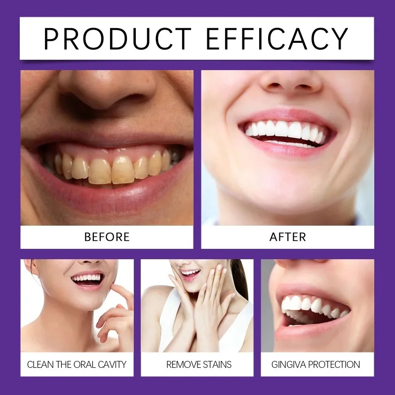 Polvere Minerale Viola per il  - Teeth Whitening Near Me recensione e prezzo